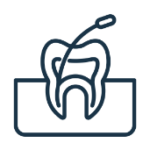 Root canal treatment