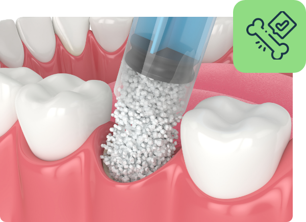 Demonstration Bone Grafting