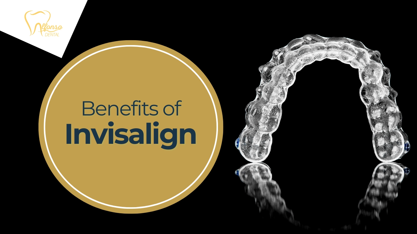 Benefits of Invisalign