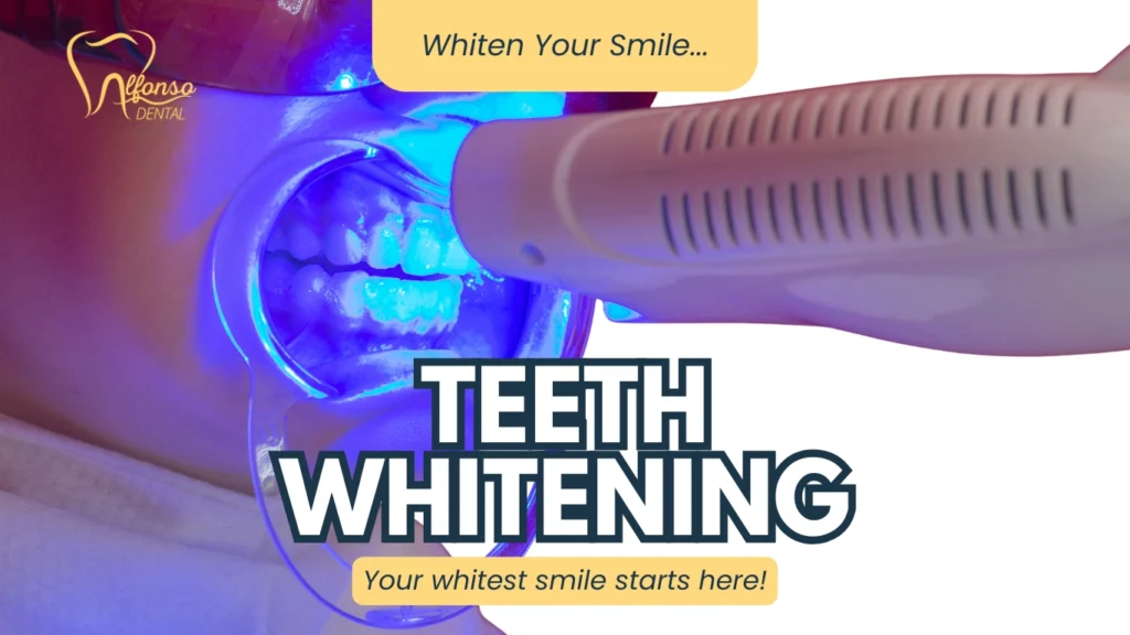 Brighten Your Smile: Discover Professional Teeth Whitening at Alfonso Dental