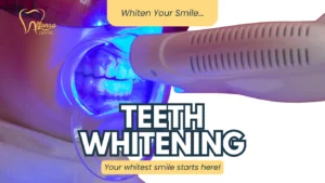 Brighten Your Smile: Discover Professional Teeth Whitening at Alfonso Dental