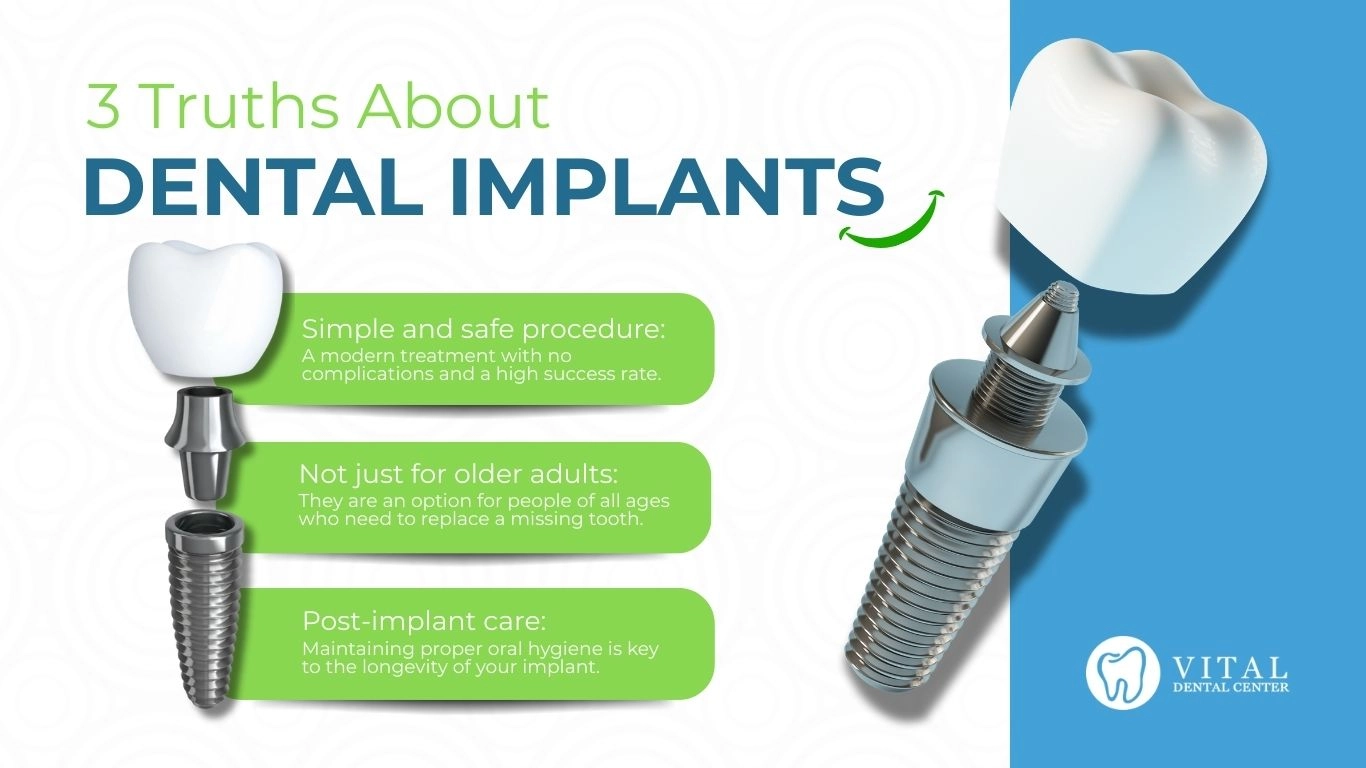 Dental Implants at Alfonso Dental | Restore Your Smile and Confidence